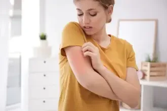 Alergiile sezoniere si urticaria alergica