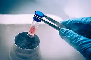 Studiu: celulele stem sunt benefice in tratarea disfunctiilor erectile ulterioare tratamentului de cancer
