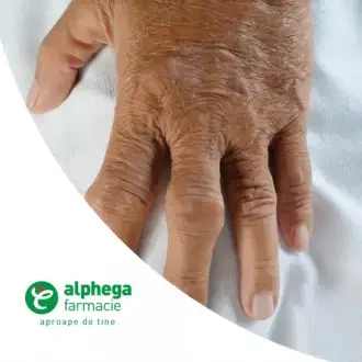 Guta la articulatiile degetelor de la mana, Durere articulară a degetului inelar