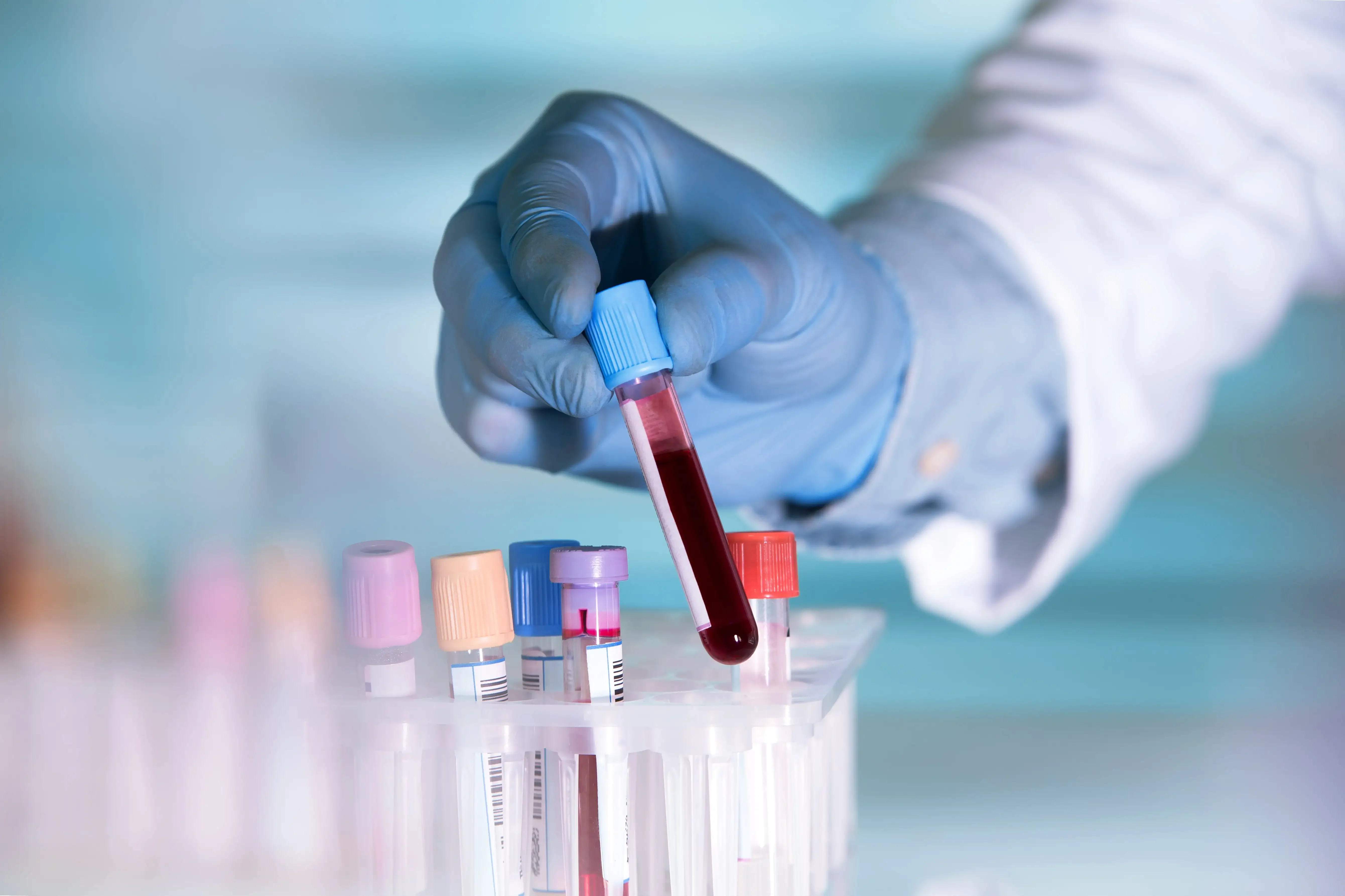 Un nou test de sânge poate detecta cu exactitate boala Alzheimer ...