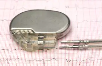 Viața după implantul de pacemaker