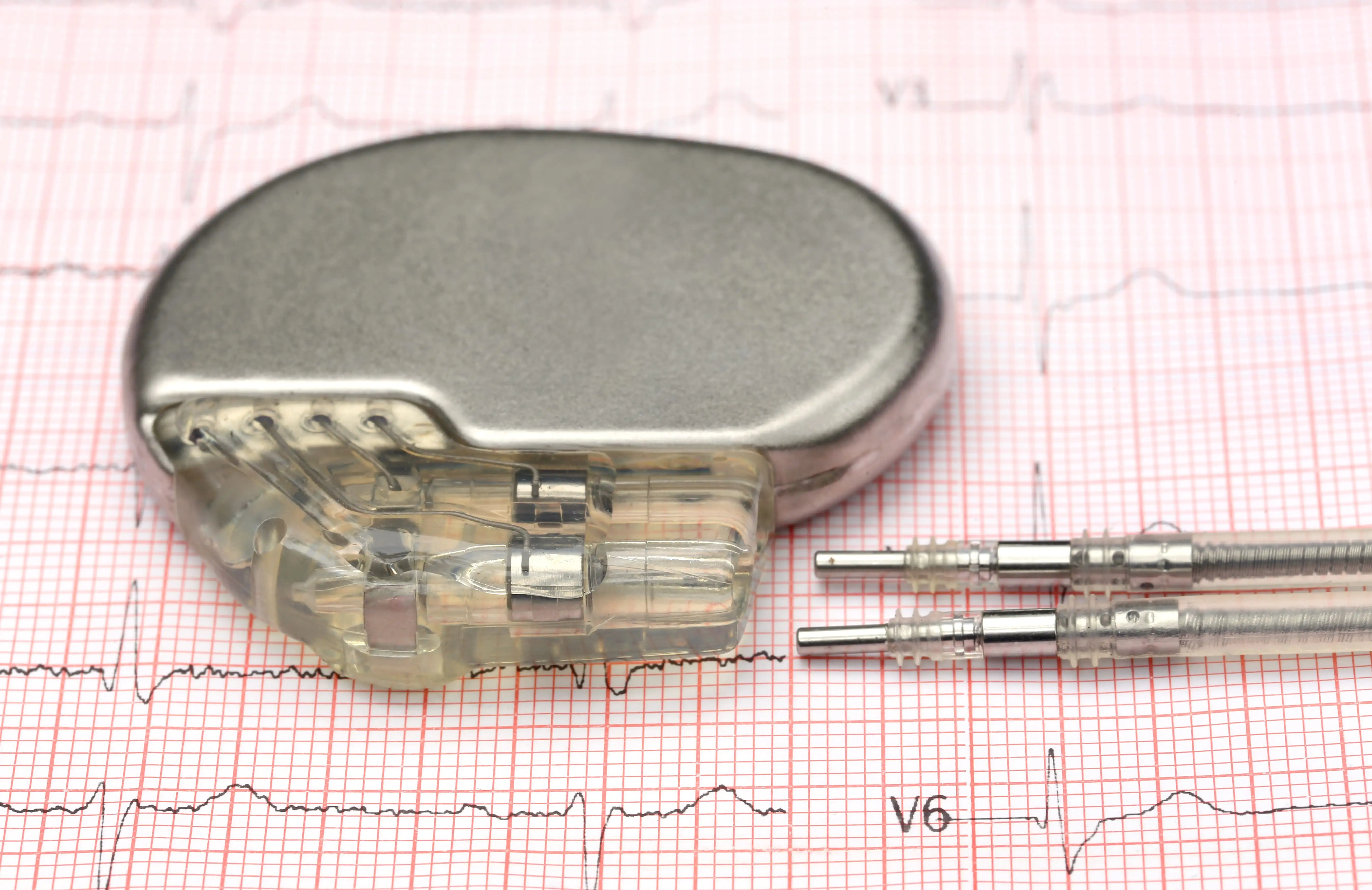 Viața după implantul de pacemaker